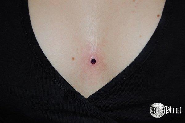 microdermal mostek